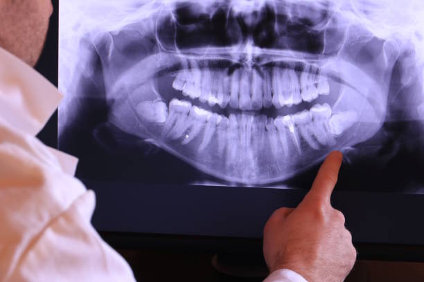 Best Emergency TMJ Treatment in Upper Arlington, OH