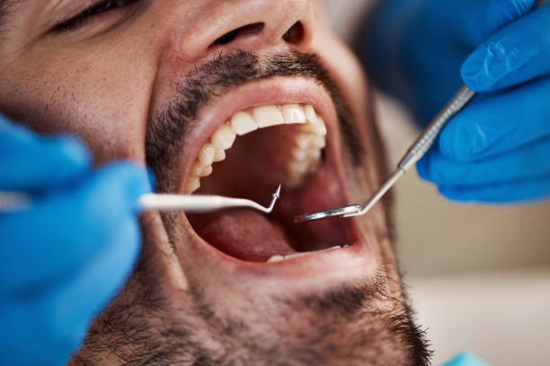 Best Pediatric Emergency Dentist in Upper Arlington, OH
