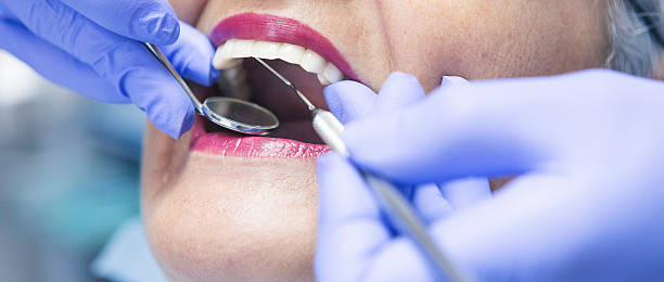 Best Emergency Tooth Extraction in Upper Arlington, OH